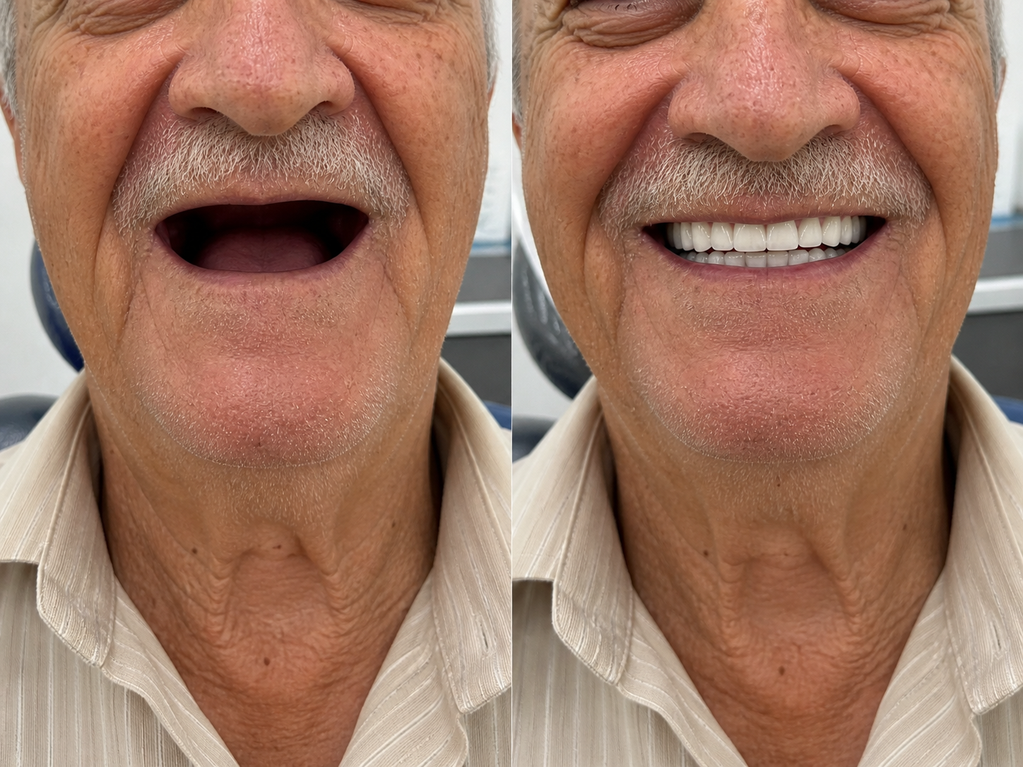 Antes e depois — paciente Oral Você