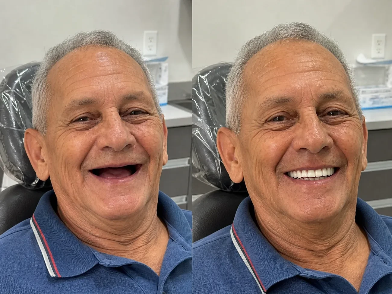 Antes e depois — paciente LP Odonto Prime