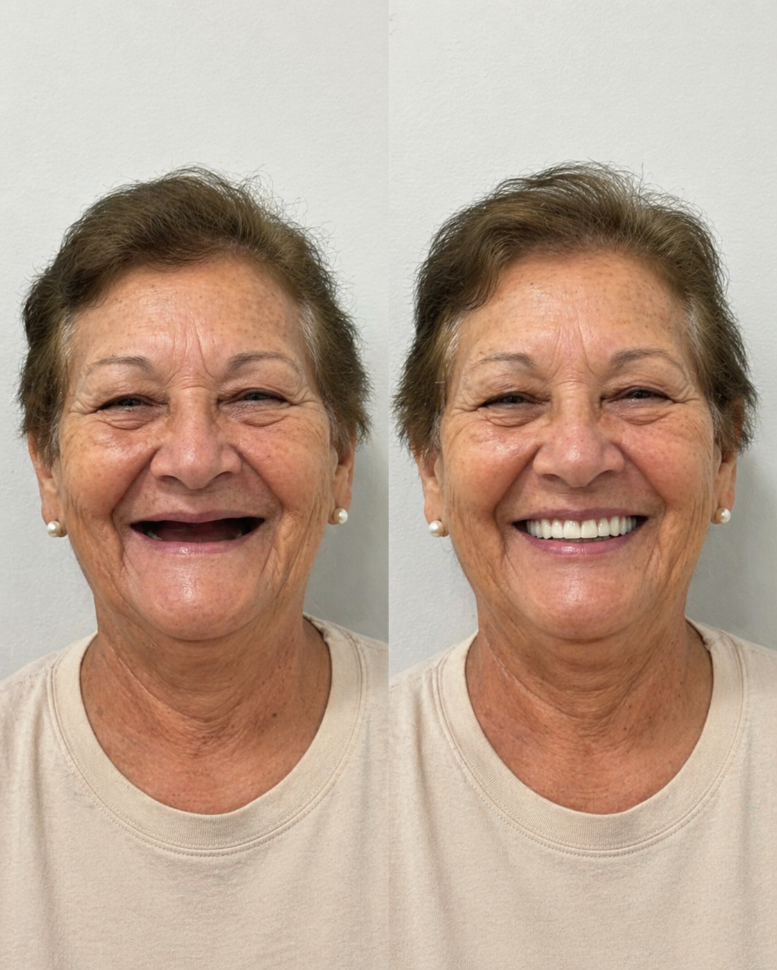 Resultado Oral Você — caso 2