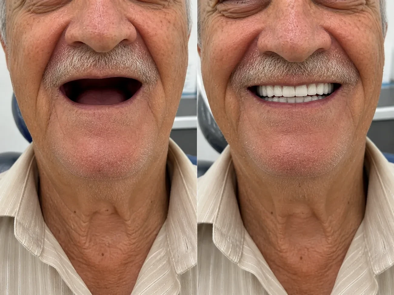 Antes e depois — paciente LP Odonto Prime