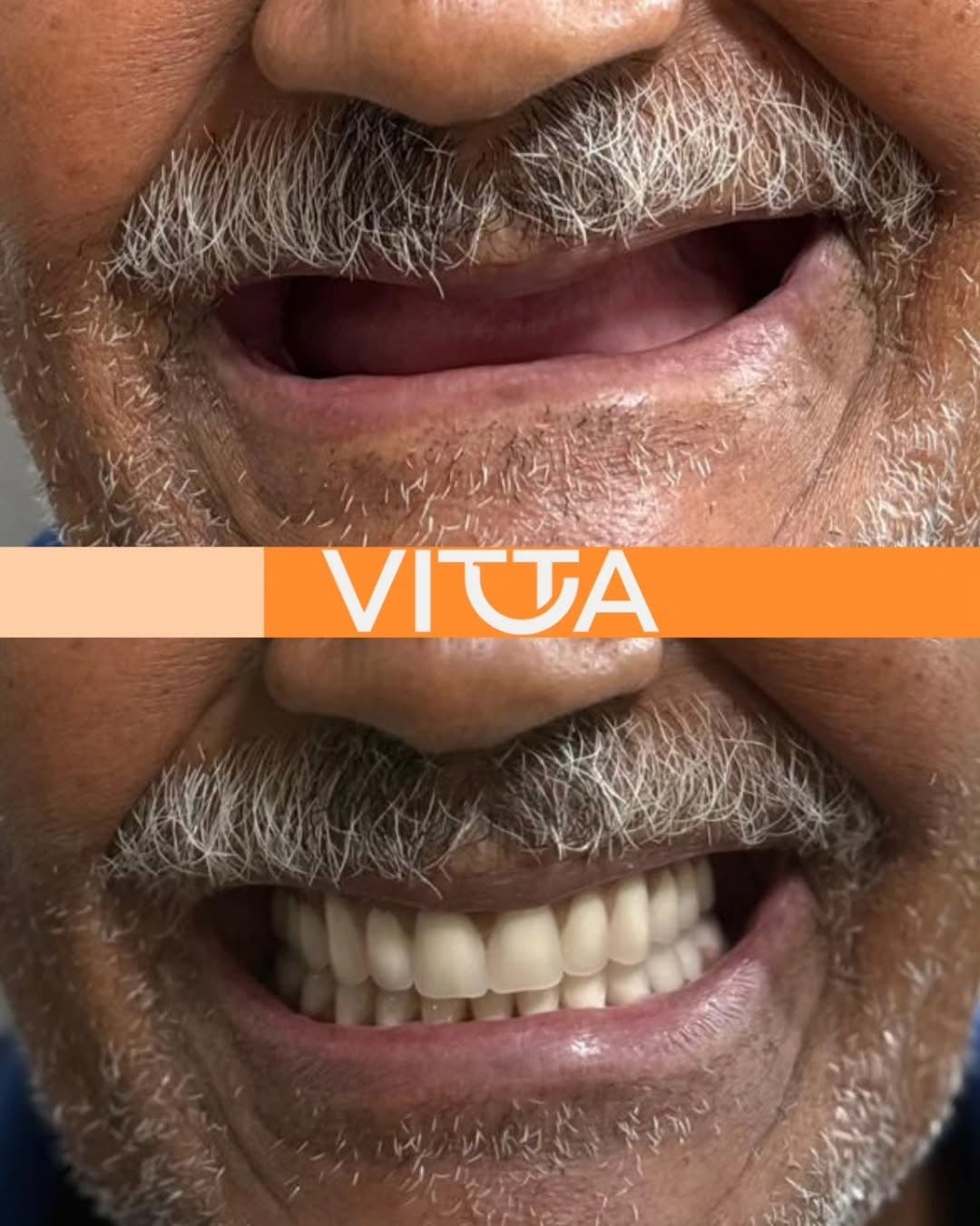 Sorriso planejado individualmente - Vitta