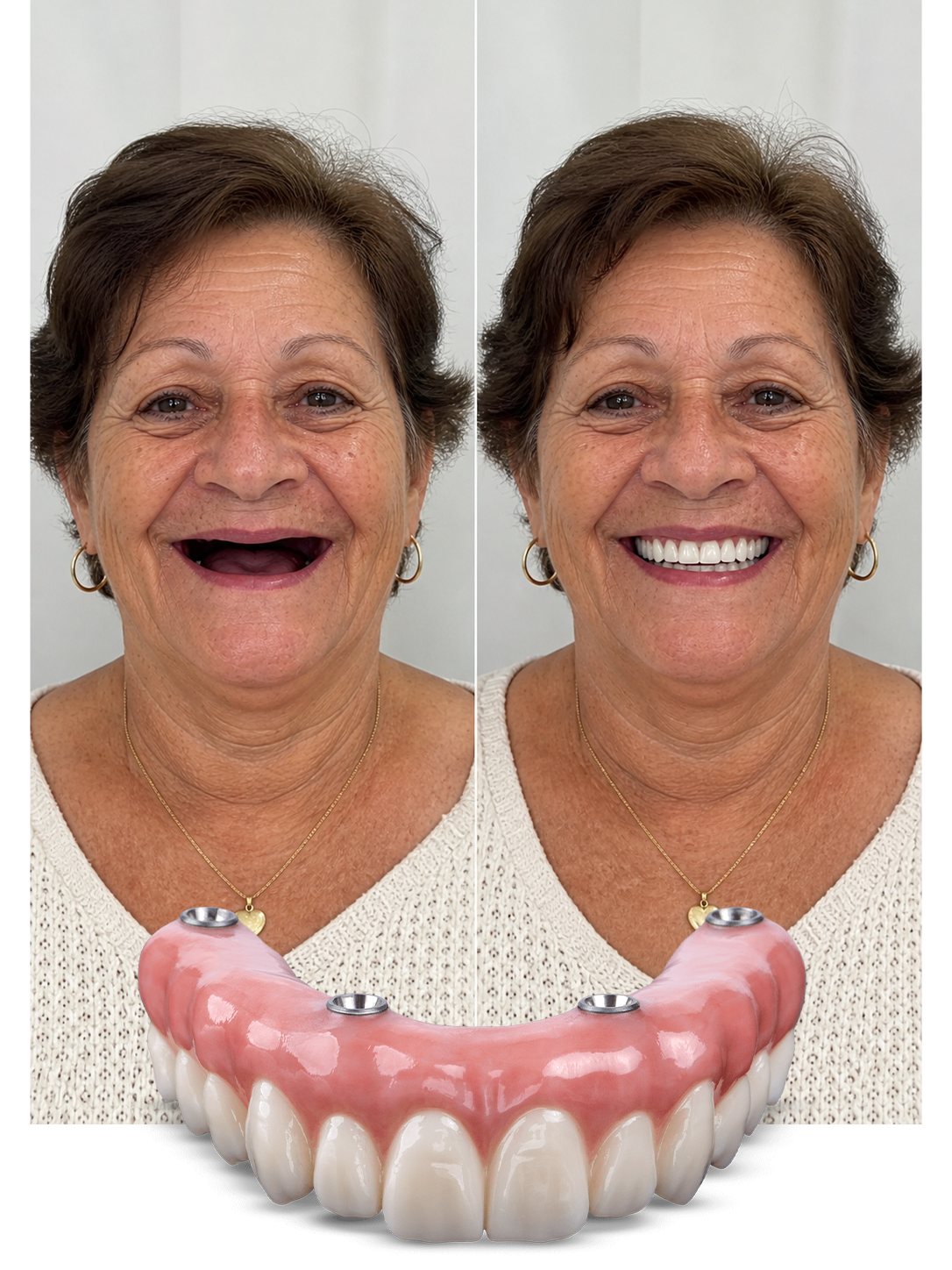 Dentes fixos — Ortosam Brasília