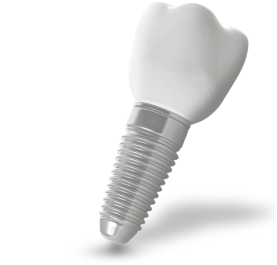 Implantes