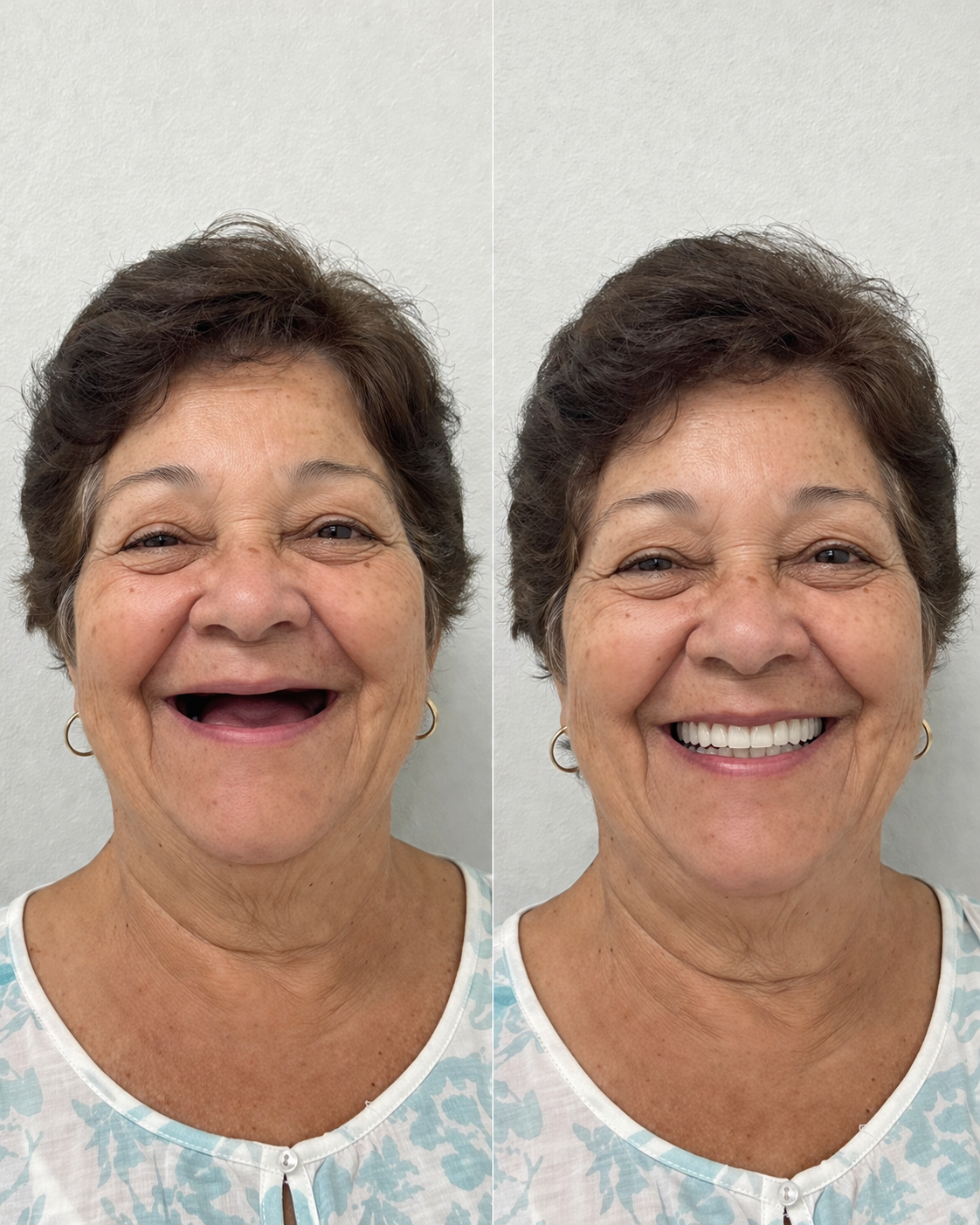 Resultado Oral Você — caso 4