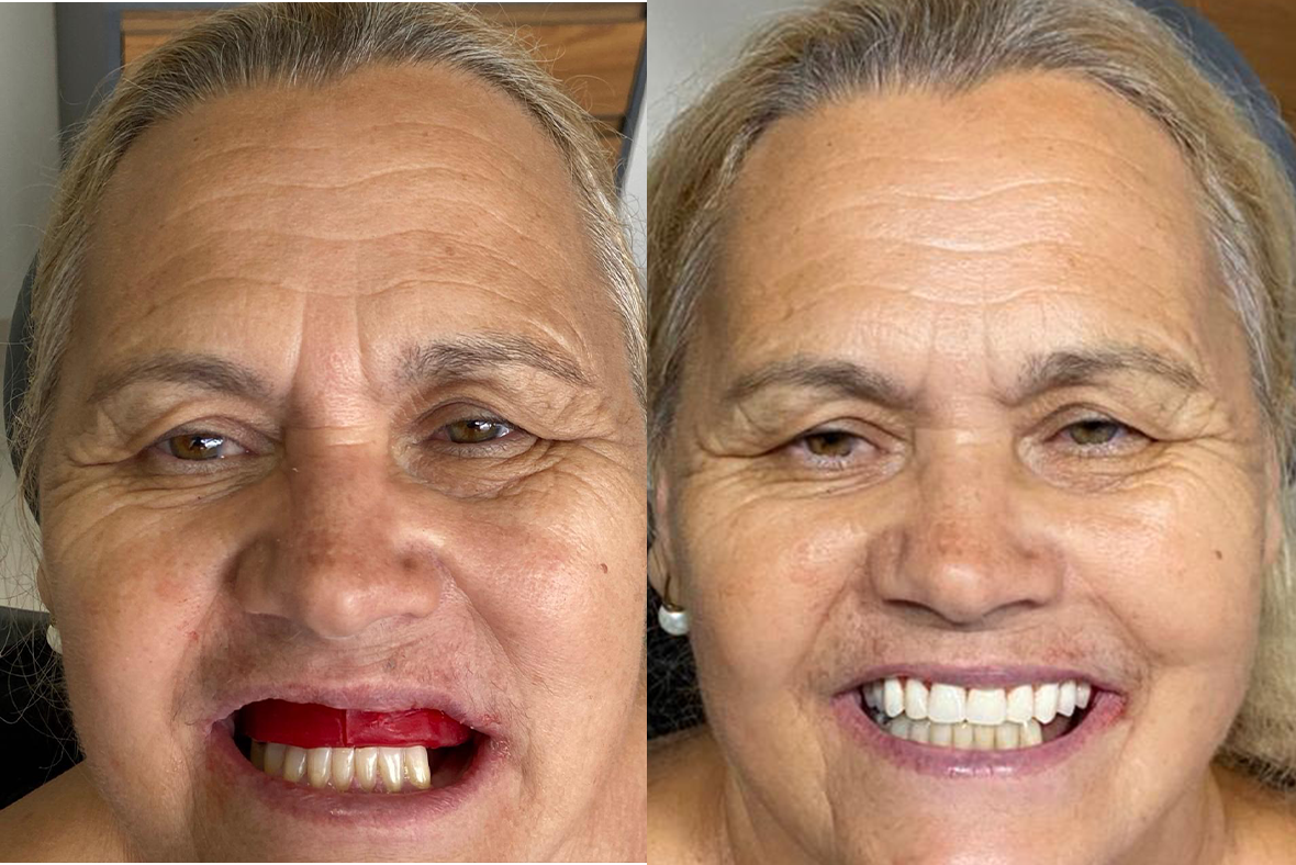 Resultado Carvalho Odontologia — caso 3