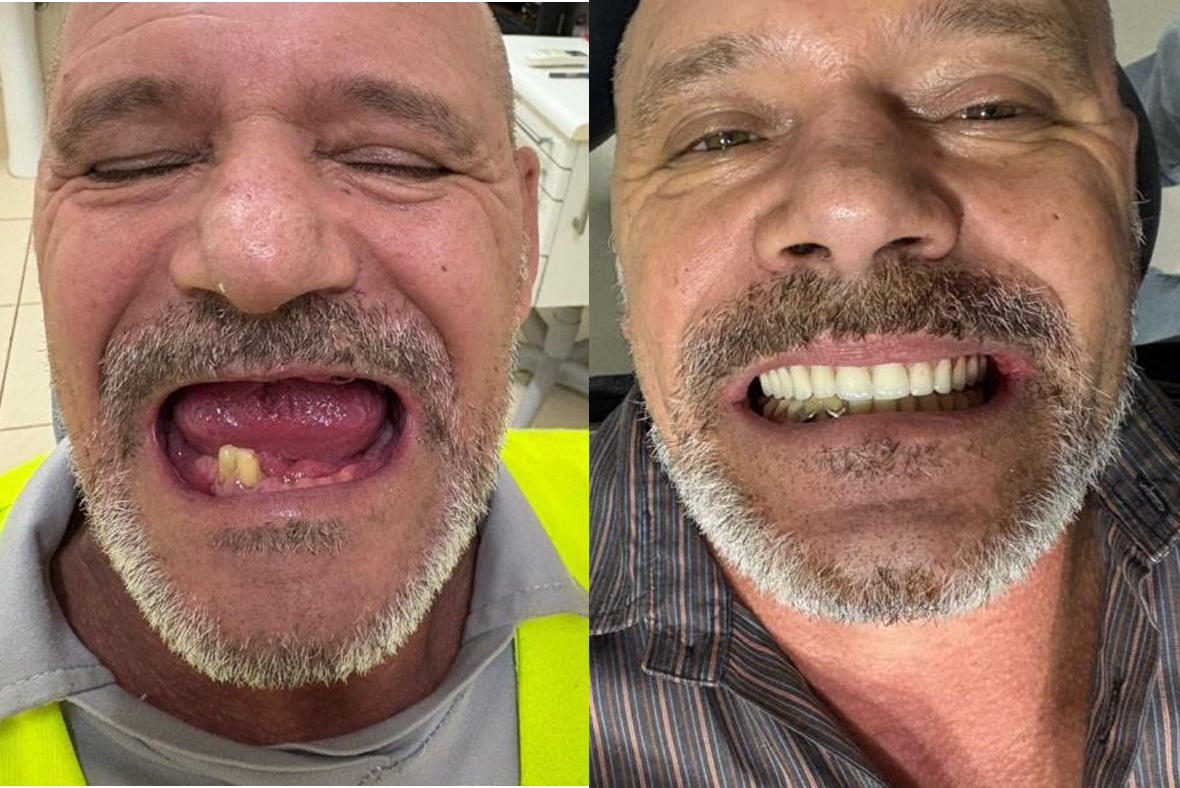 Resultado Carvalho Odontologia — caso 2