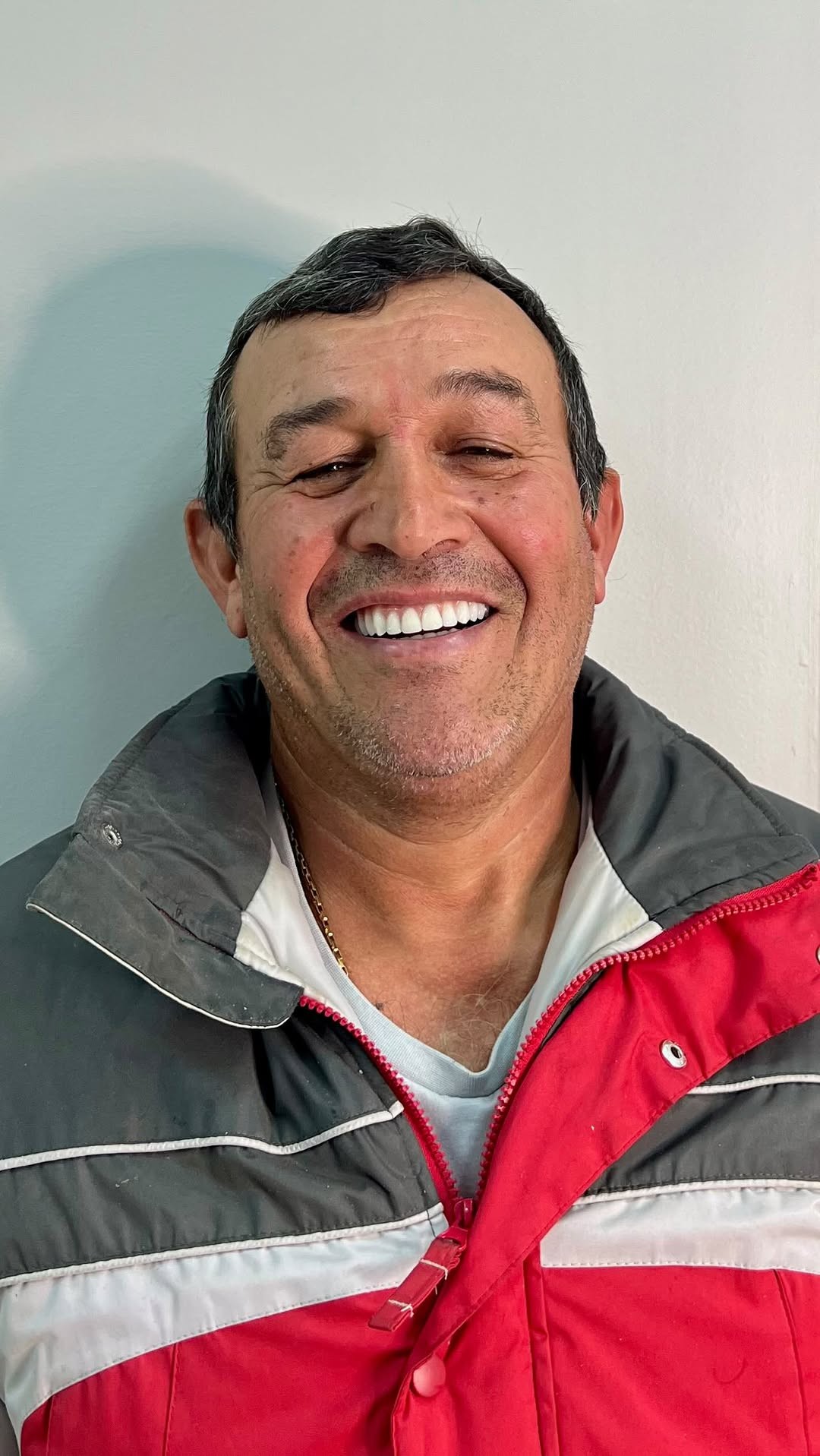 Antes e depois — paciente LP Odonto Prime