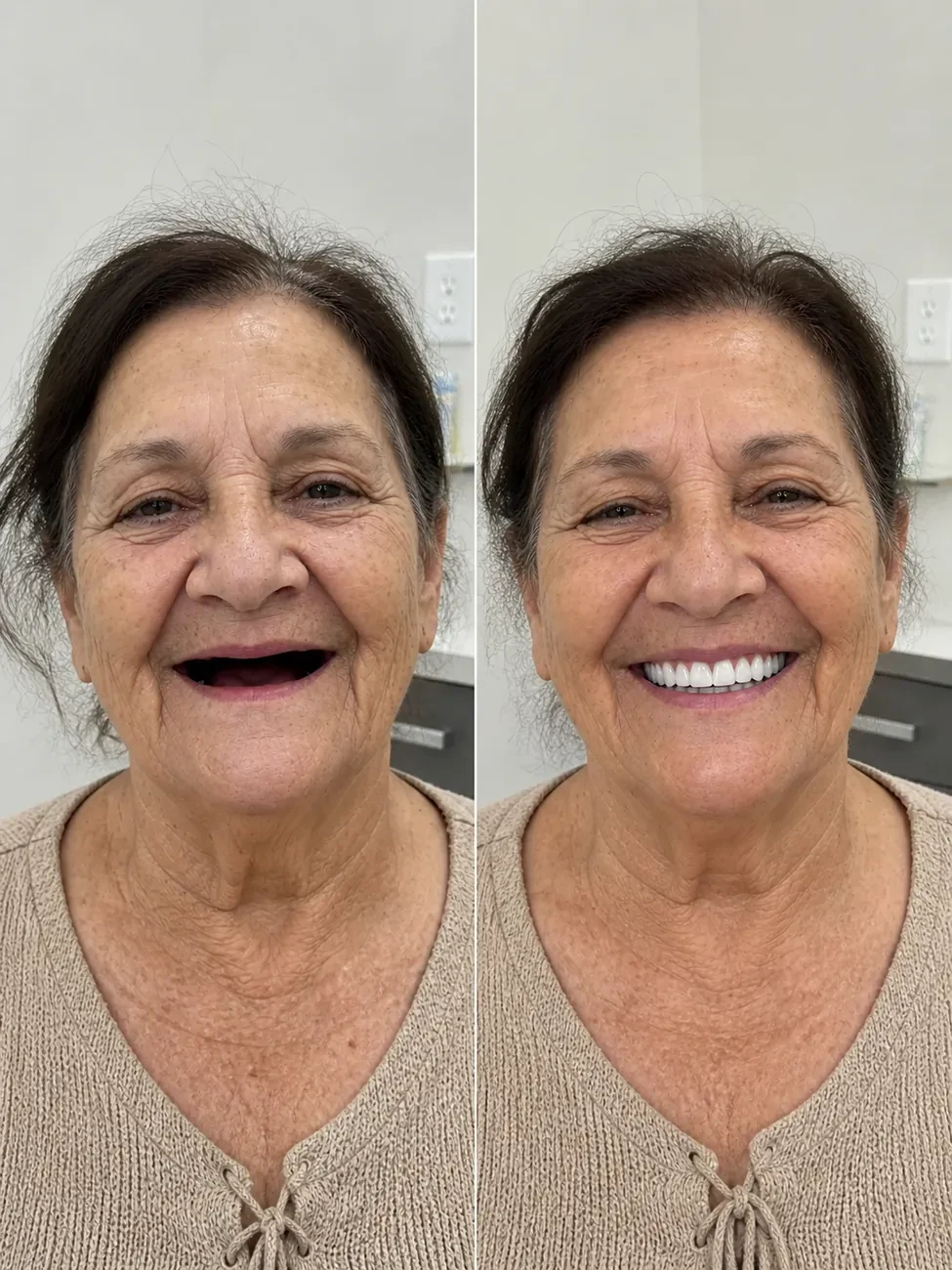 Antes e depois — paciente LP Odonto Prime