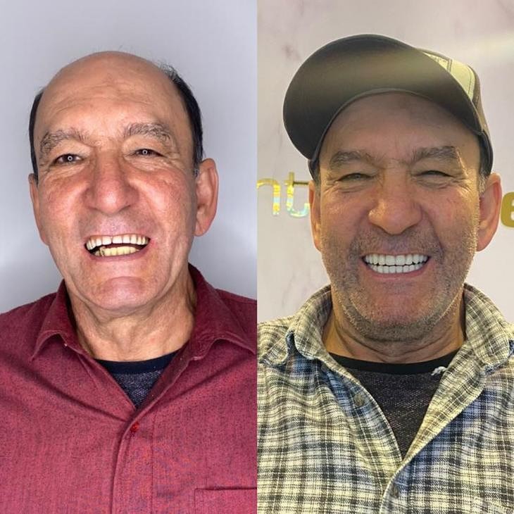 Antes e depois — paciente LP Odonto Prime