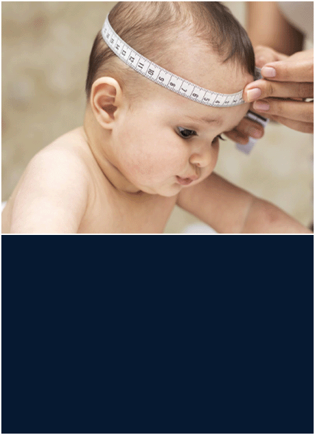 Plagiocefalia e assimetria craniana, osteopatia infantil Sinop