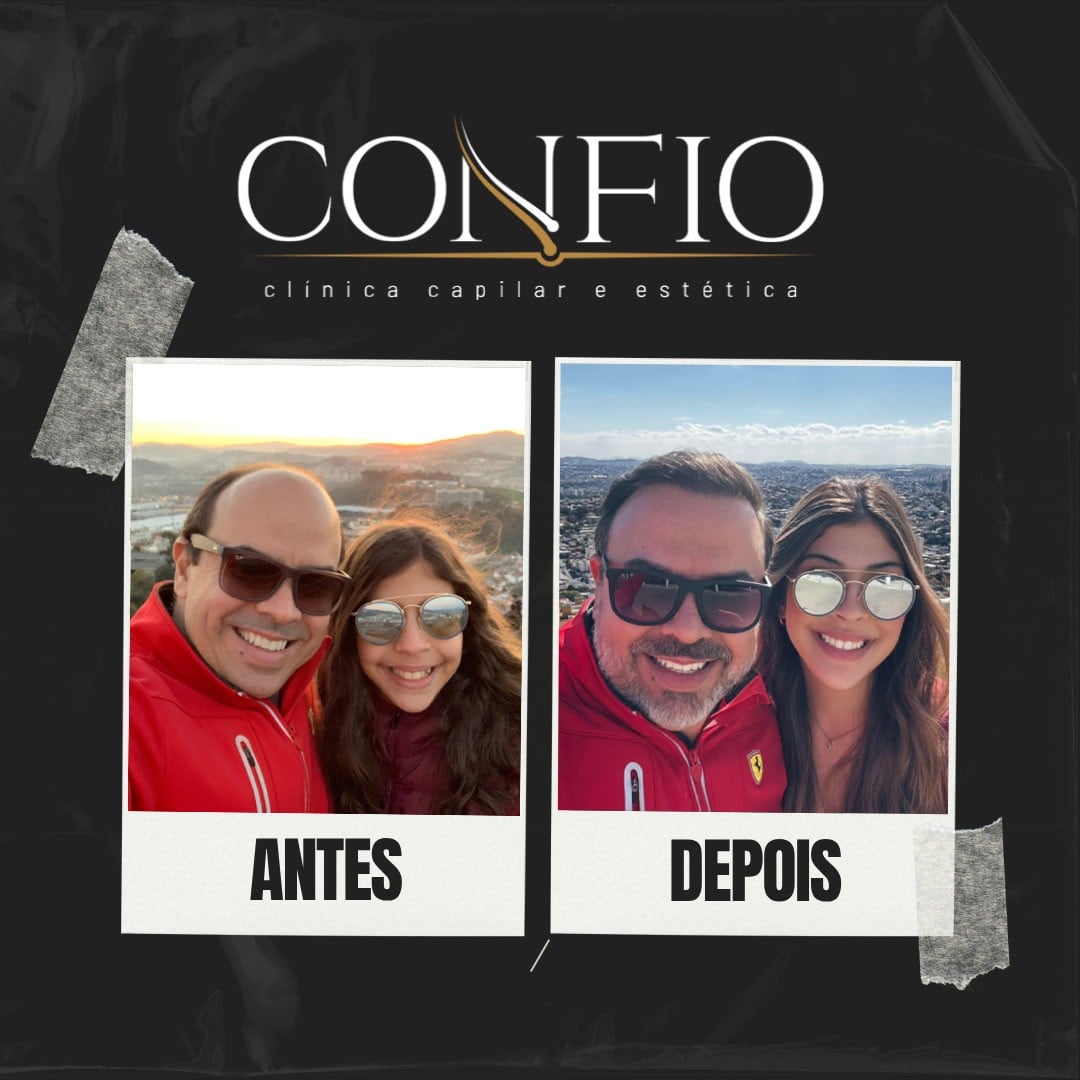 Antes e depois 5