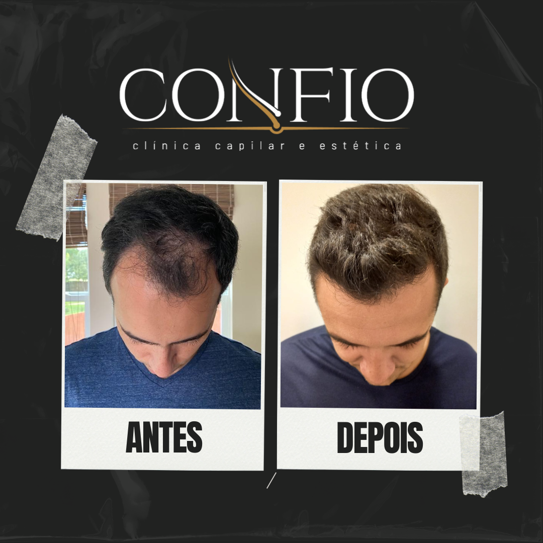 Antes e depois 6