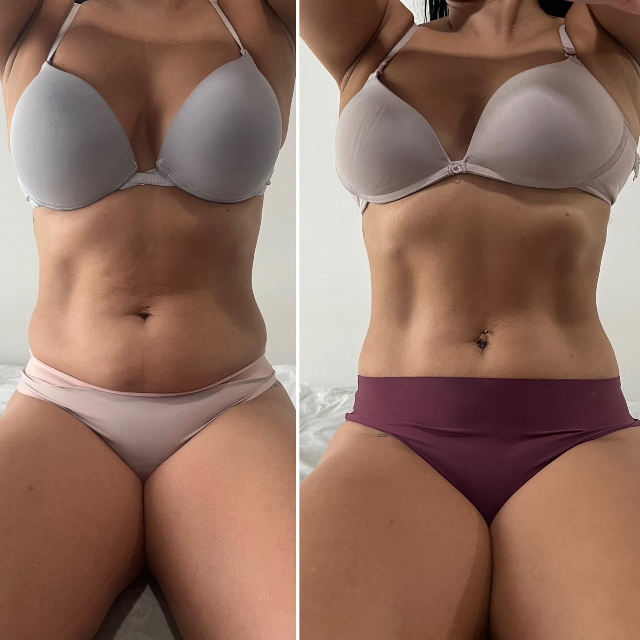 Contorno corporal · comparativo frontal, imagem enviada pela Empoderada Estética