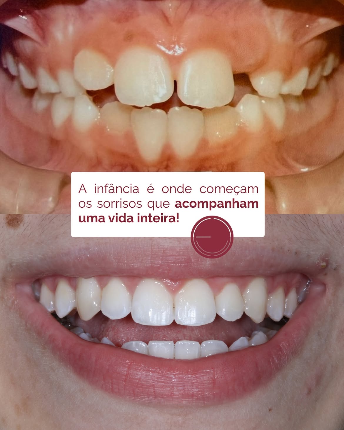 Resultado