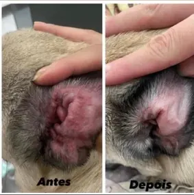 Otite de repetição