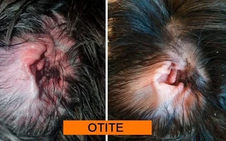 Antes e depois: Otite