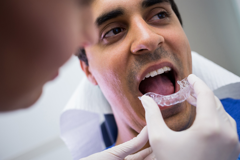 Alinhadores Transparentes (Invisalign)