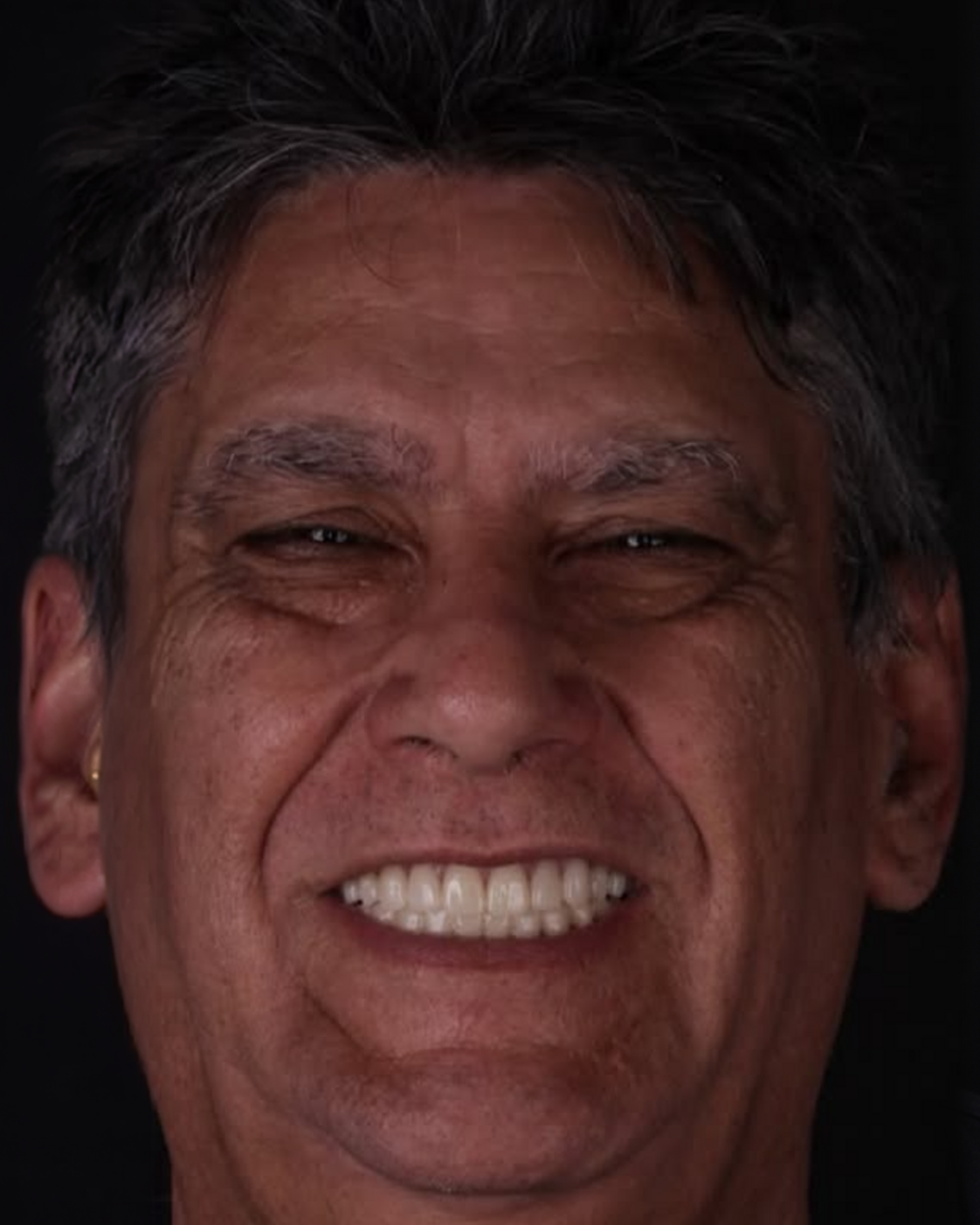 Depois