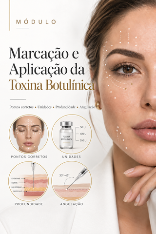 Capa do bônus Marcação e aplicação da toxina botulínica.