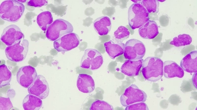 Hematologia Laboratorial e Clínica