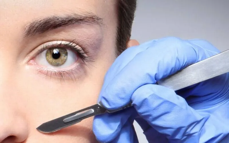 Curso de Dermaplaning em BH na Life Cursos