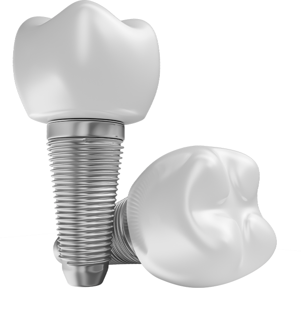 Implante dentário